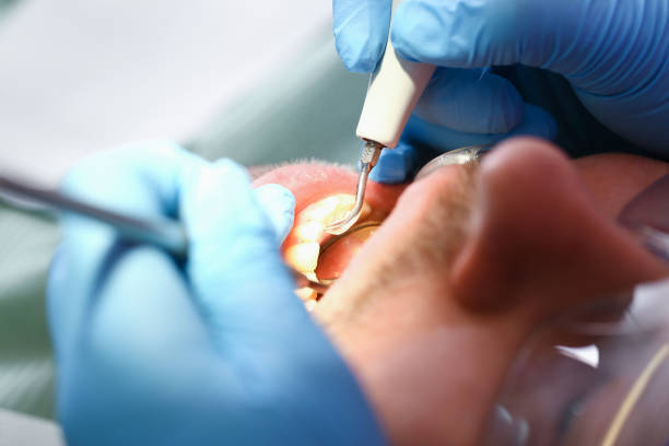 Best Weekend Emergency Dentist in Luna Pier, MI